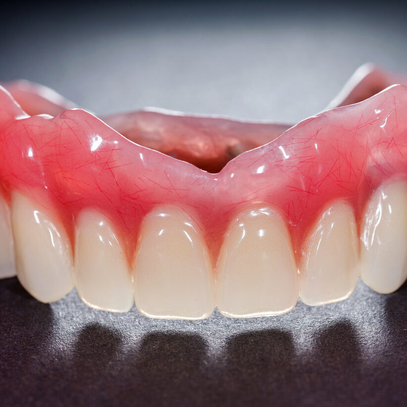 dentures-4736x3043